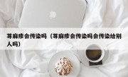 荨麻疹会传染吗（荨麻疹会传染吗会传染给别人吗）