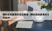 晒伤后皮肤发红怎么修复（晒伤后皮肤发红几天能好）