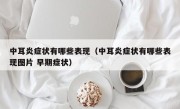 中耳炎症状有哪些表现（中耳炎症状有哪些表现图片 早期症状）