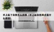 手上起了白斑怎么回事（手上起白色斑点是什么原因）
