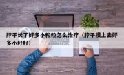脖子长了好多小粒粒怎么治疗（脖子摸上去好多小籽籽）